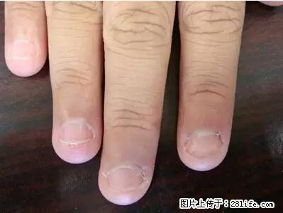 剪指甲、挖耳屎，这些日常小动作竟隐藏大危害！ - 丽水生活资讯 - 丽水28生活网 lishui.28life.net